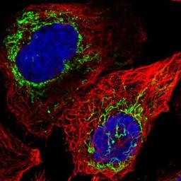 Immunocytochemistry/Immunofluorescence: SLITRK3 Antibody [NBP1-93619] - Staining of human cell line A-431 shows positivity in mitochondria.