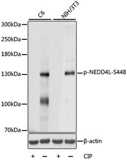 Western blot - Phospho-NEDD4L-S448 antibody (AP0843)