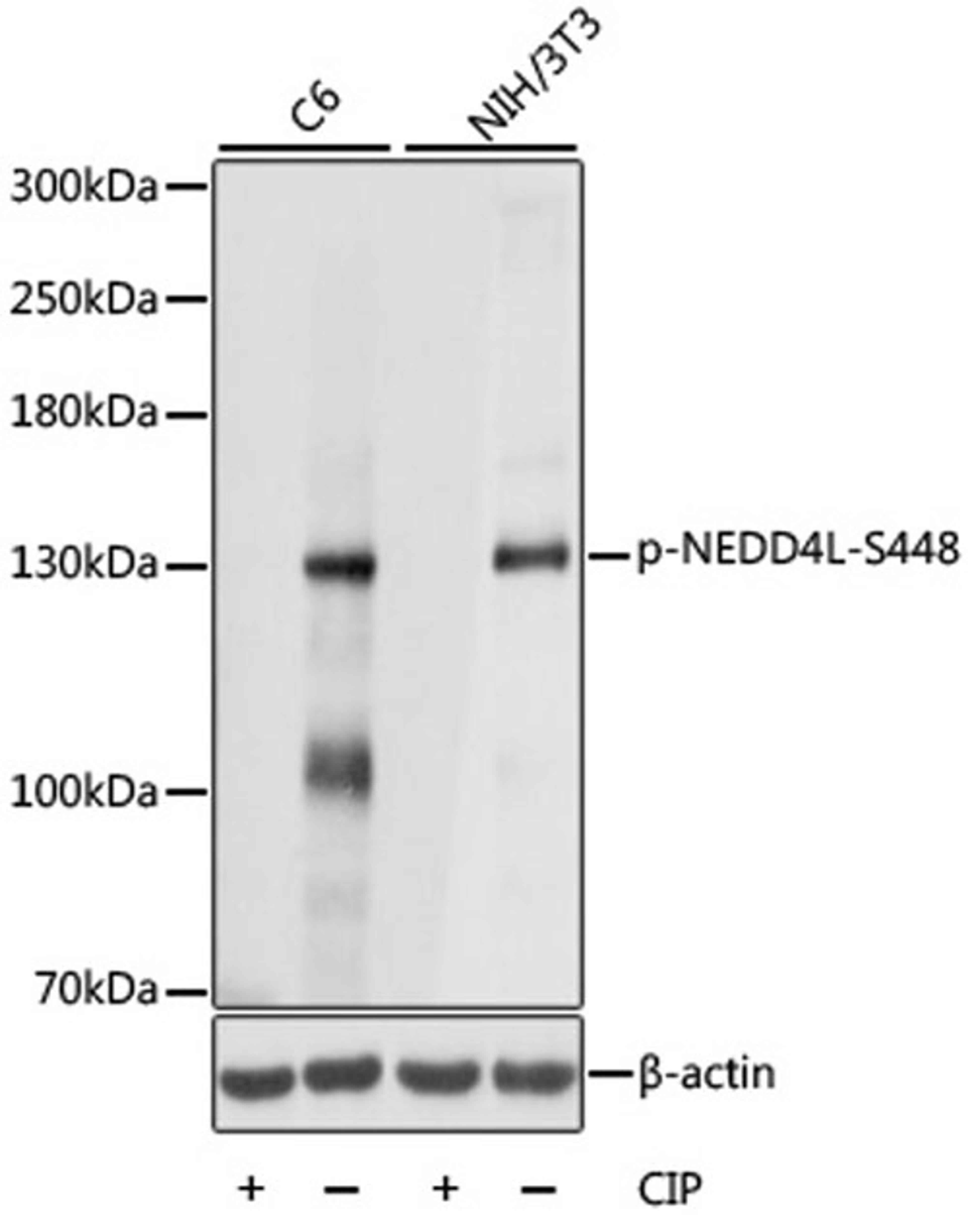 Western blot - Phospho-NEDD4L-S448 antibody (AP0843)