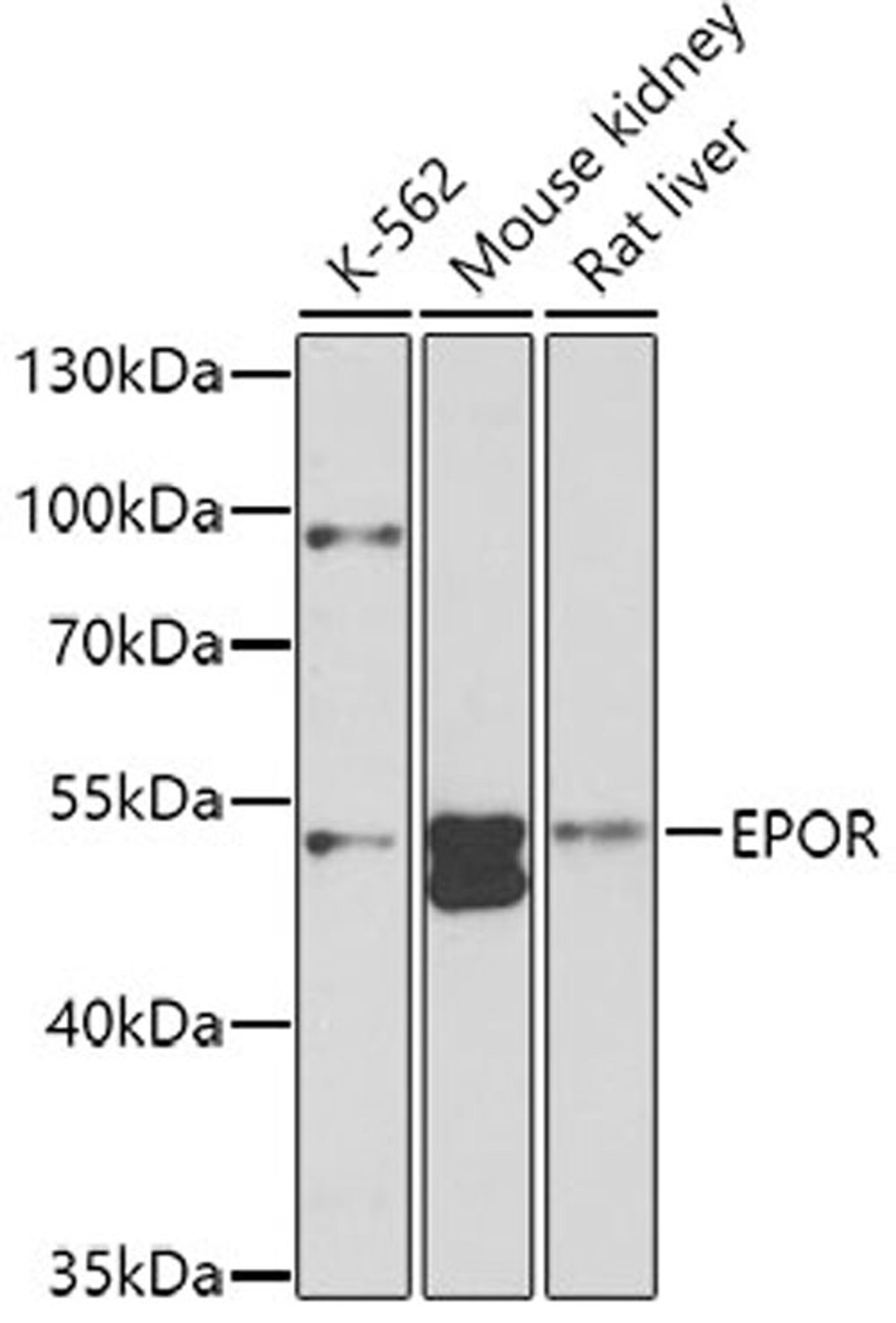 Western blot - EPOR antibody (A2917)