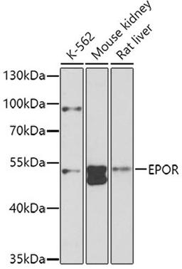 Western blot - EPOR antibody (A2917)