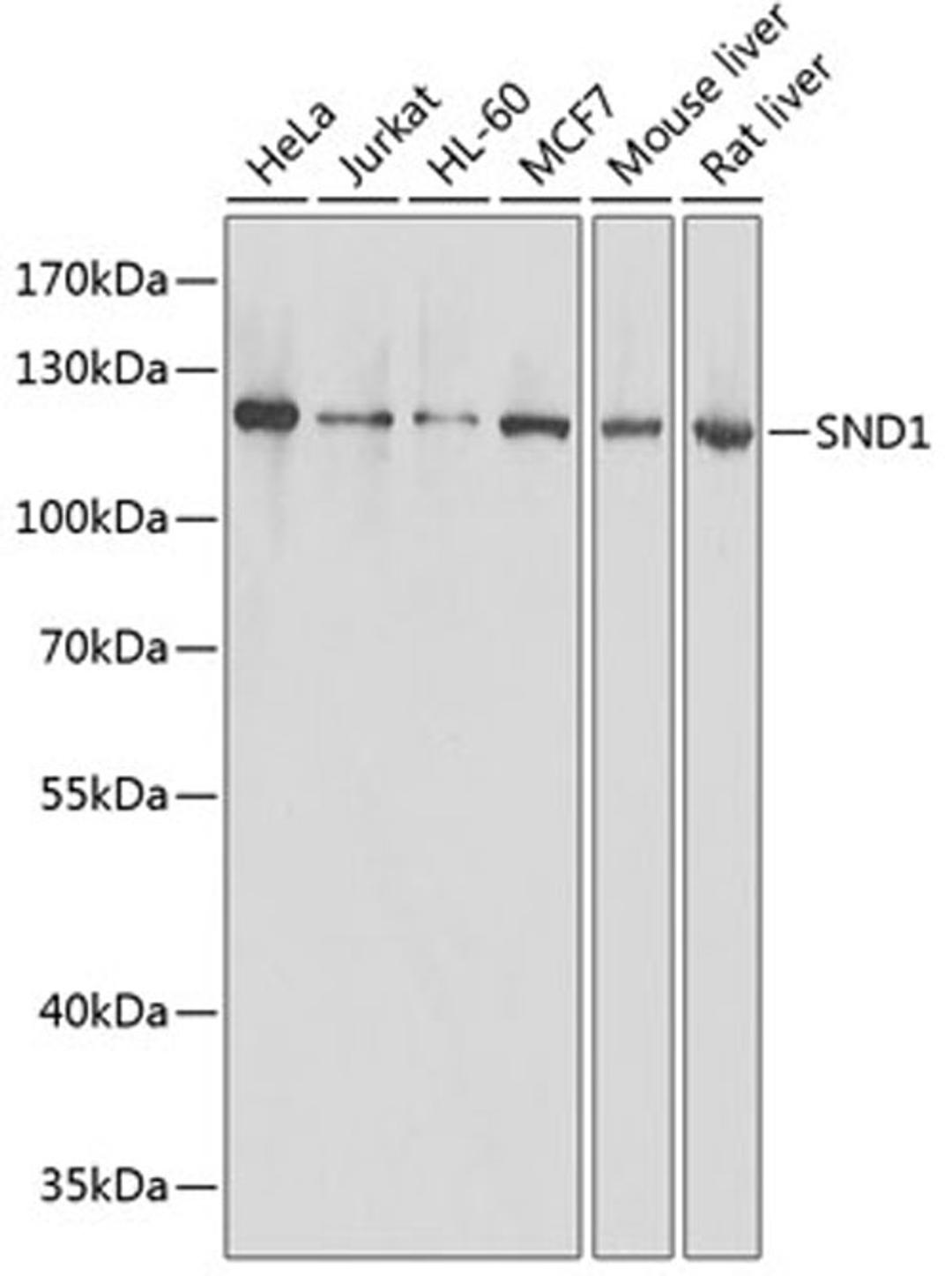 Western blot - SND1 antibody (A13415)