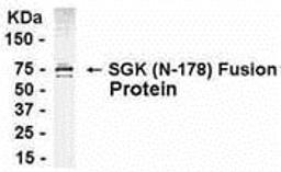 E coli-derived fusion protein as test antigen. Affinity-purified IgY dilution: 1:2000, Goat anti-IgY-HRP dilution: 1:1000. Colorimetric method for signal development.