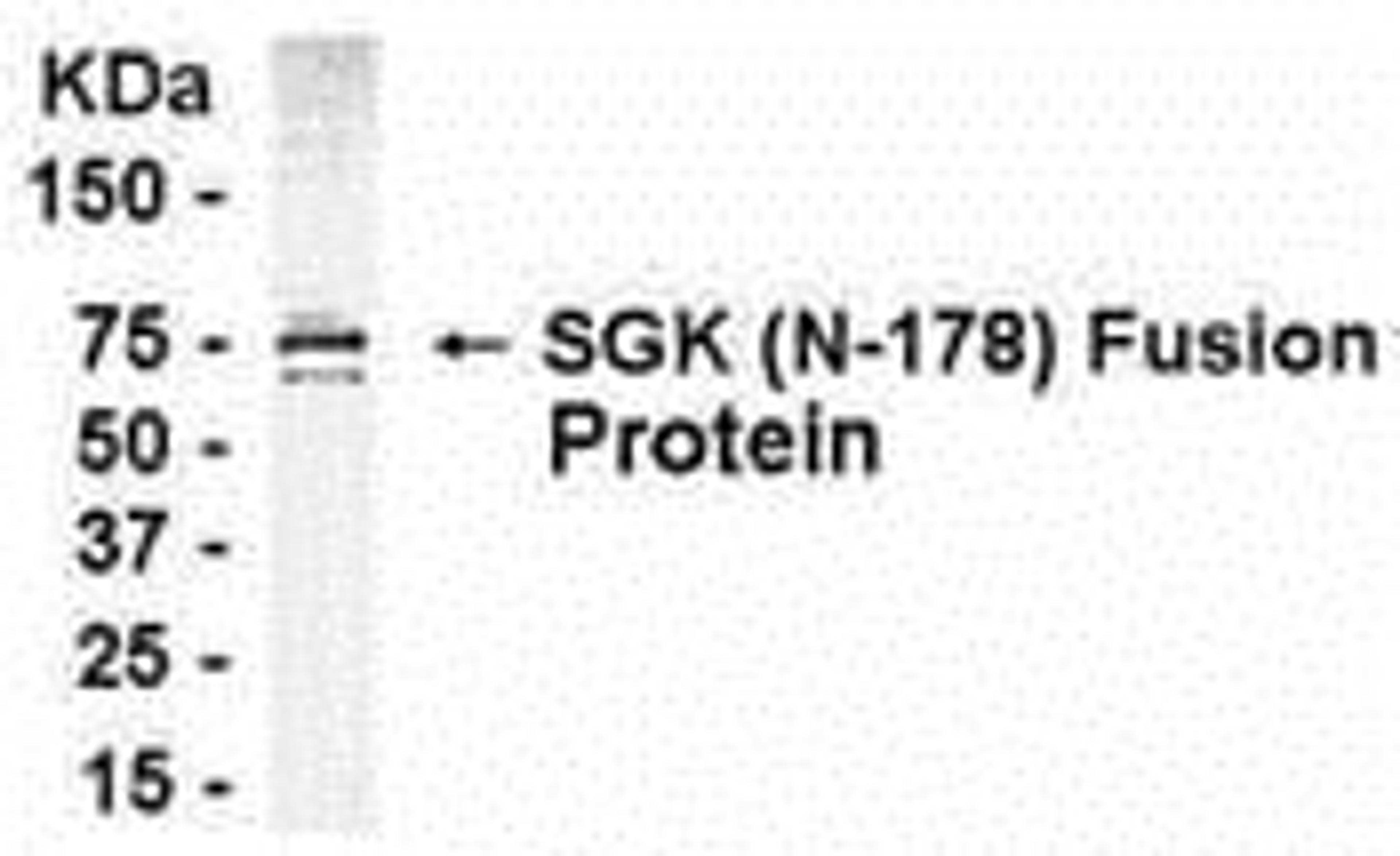 E coli-derived fusion protein as test antigen. Affinity-purified IgY dilution: 1:2000, Goat anti-IgY-HRP dilution: 1:1000. Colorimetric method for signal development.