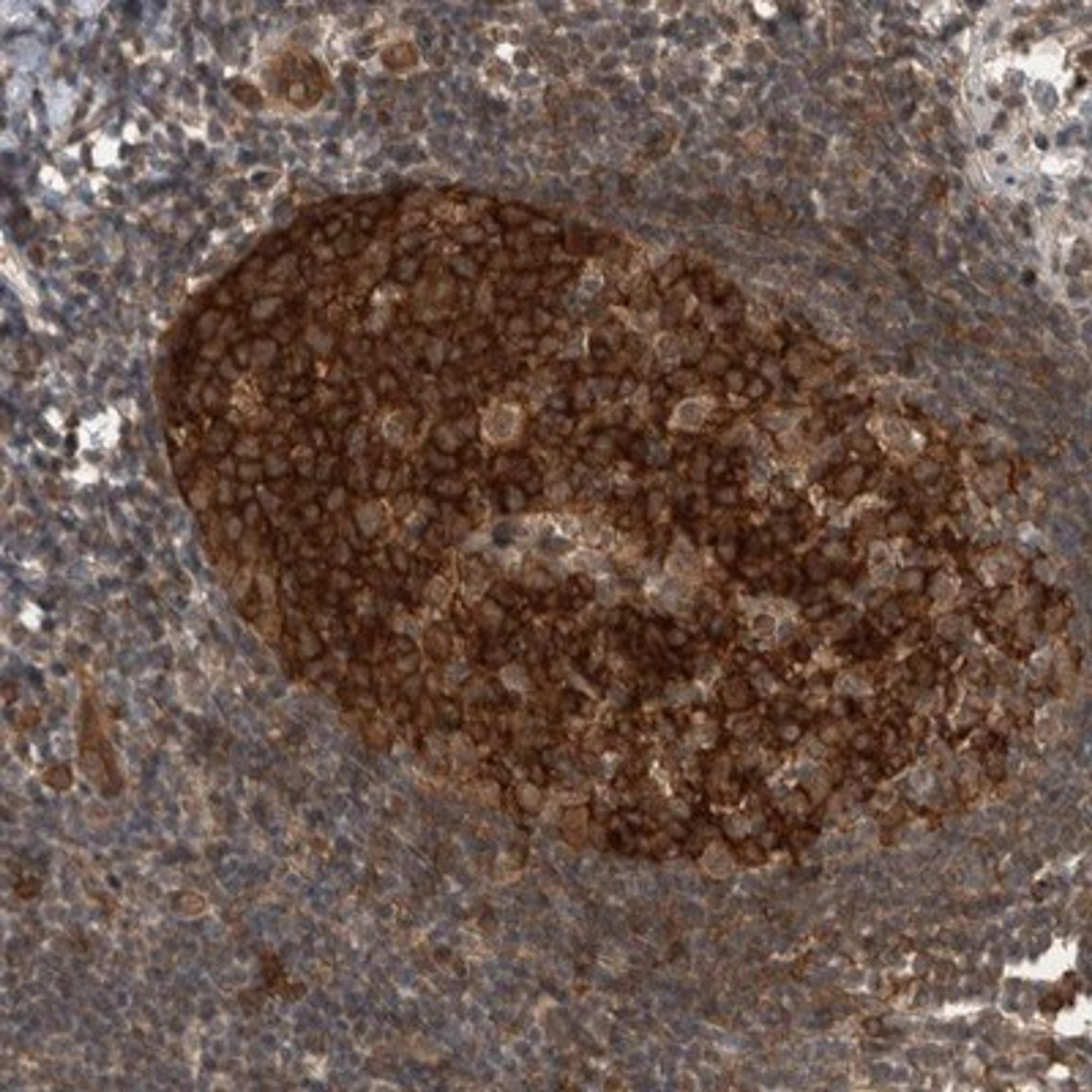 Immunohistochemistry-Paraffin: Myosin 1E Antibody [NBP1-92158] - Staining of human appendix shows strong cytoplasmic positivity in germinal center cells.