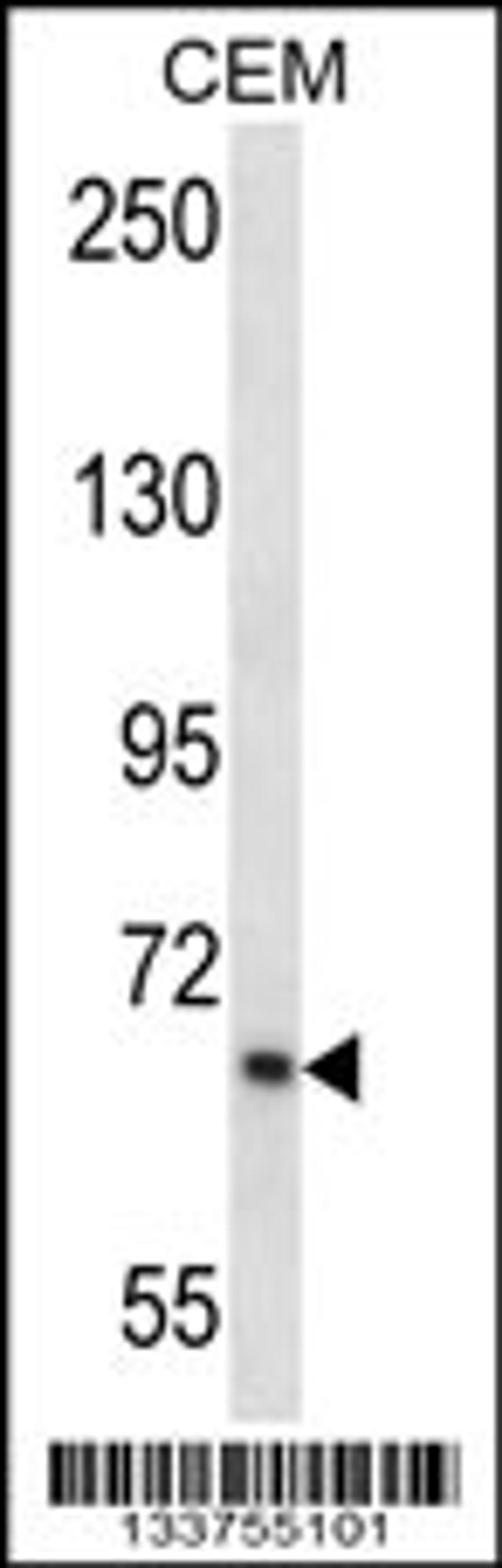 Western blot analysis in CEM cell line lysates (35ug/lane).