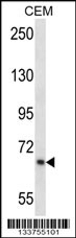 Western blot analysis in CEM cell line lysates (35ug/lane).