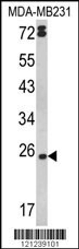 Western blot analysis of LTA Antibody in MDA-MB231 cell line lysates (35ug/lane)