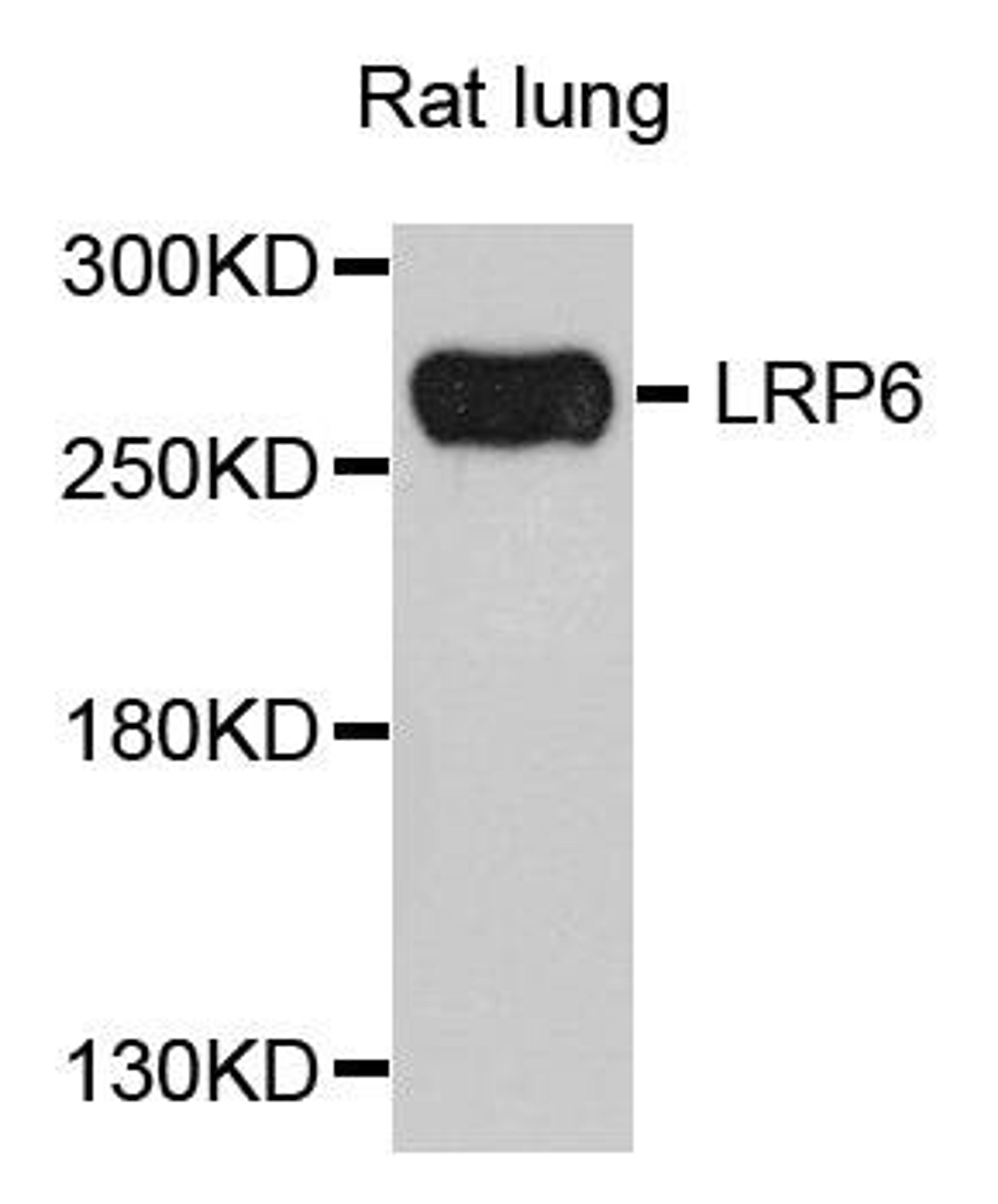 Western blot analysis of extract of various cells using LRP6 antibody