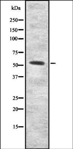 Western blot analysis of HEK293 cells using INAR2 antibody