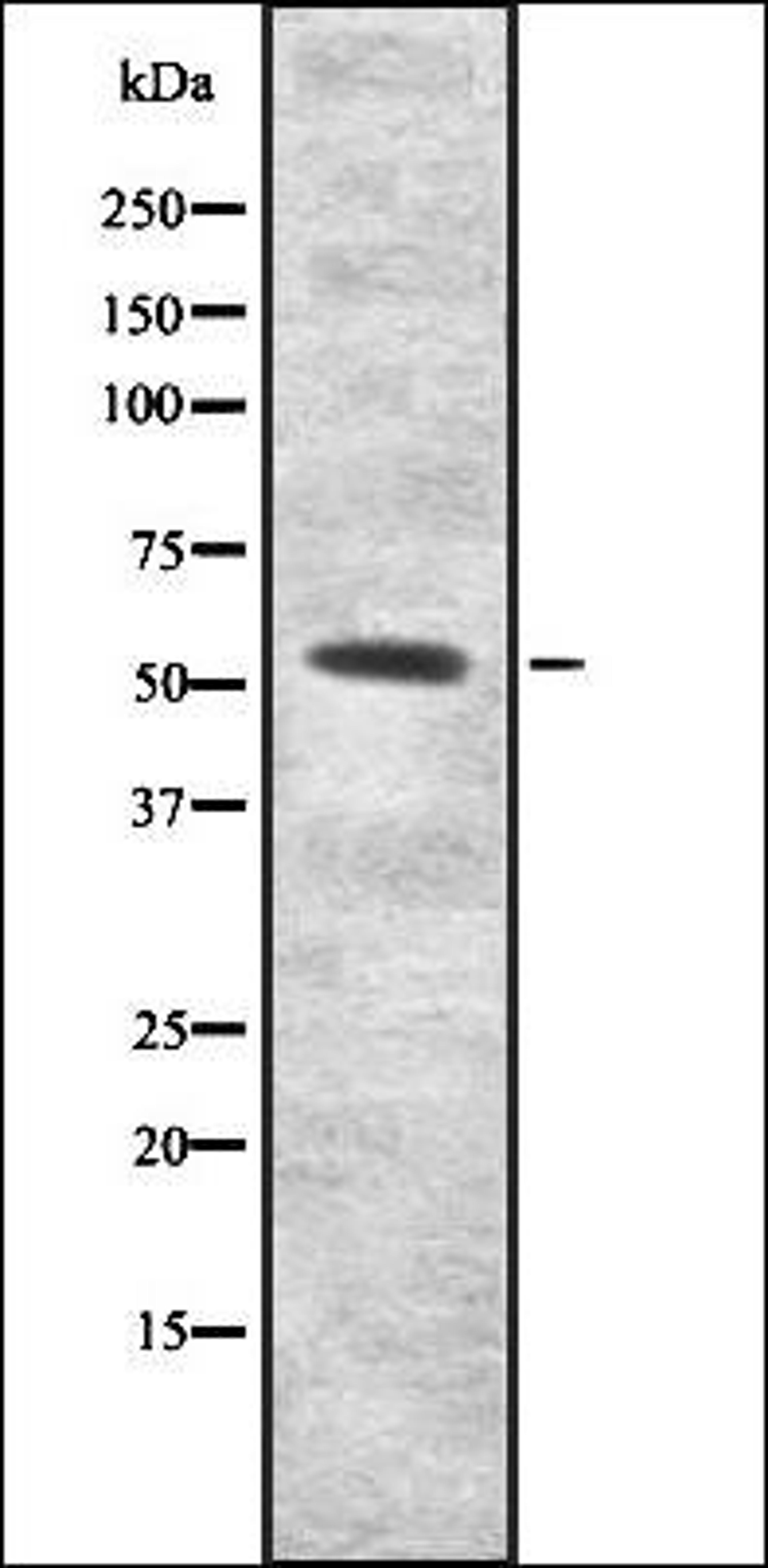 Western blot analysis of HEK293 cells using INAR2 antibody