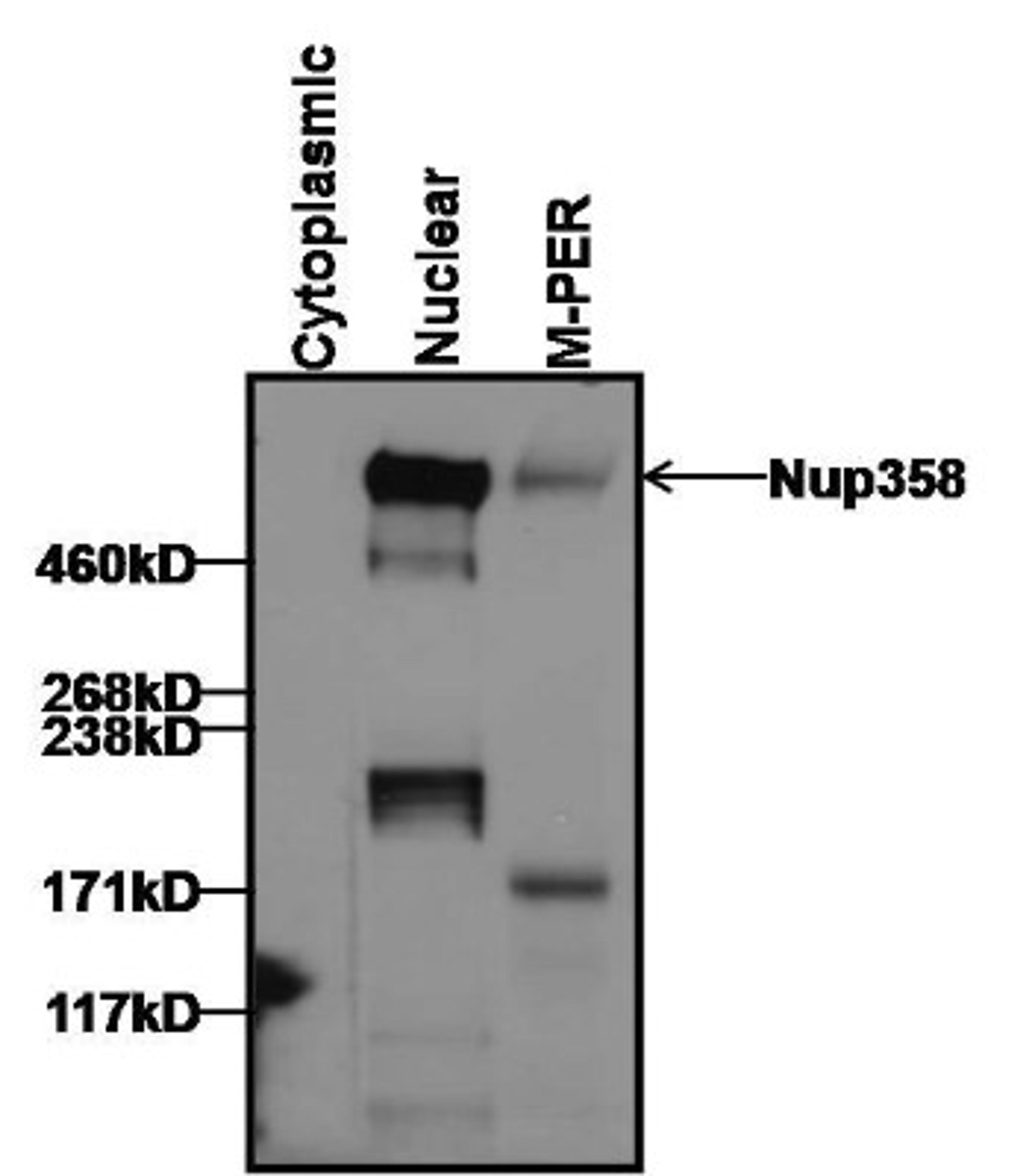 Western Blot: RanBP2 Antibody (2E1) [NB100-74480] - Analysis of 25ug of cytoplasmic and nuclear HeLa cell lysates prepared using NE-PER Nuclear and Cytoplasmic Extraction Reagents per well, 16ug of HeLa whole cell lysate prepared using M-PER Mammalian Protein Extraction Reagent, and 10ul of PageRuler Plus Prestained Protein Ladder.