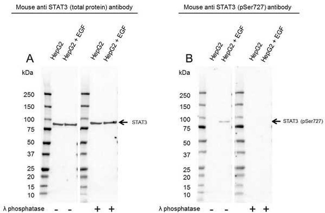 Western Blot analysis of HepG2 untreated and EGF treated whole cell lysates