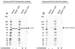 Western Blot analysis of HepG2 untreated and EGF treated whole cell lysates