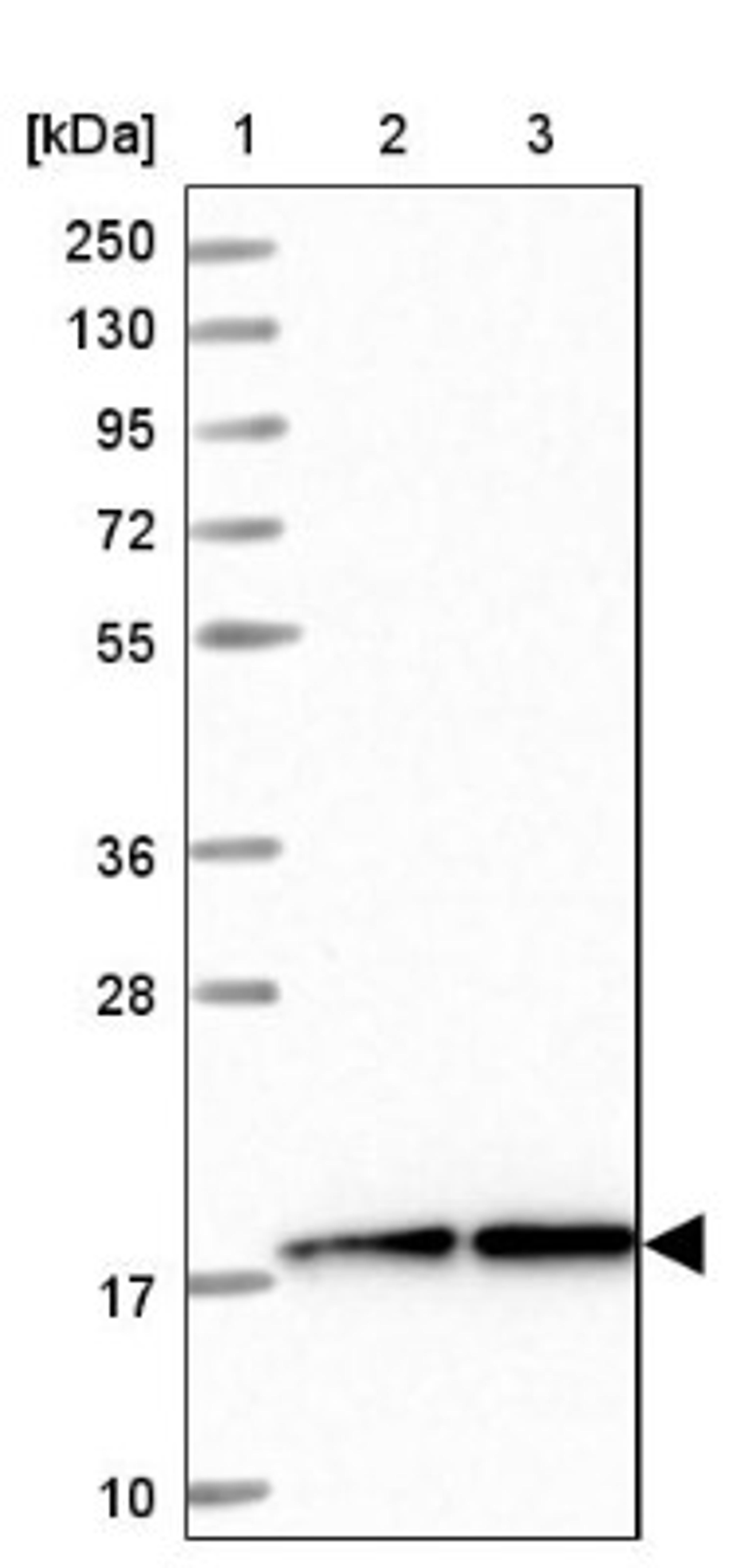 Immunohistochemistry: LEUTX Antibody [NBP1-90890] - Lane 1: Marker [kDa] 250, 130, 95, 72, 55, 36, 28, 17, 10<br/>Lane 2: Human cell line RT-4<br/>Lane 3: Human cell line U-251MG sp