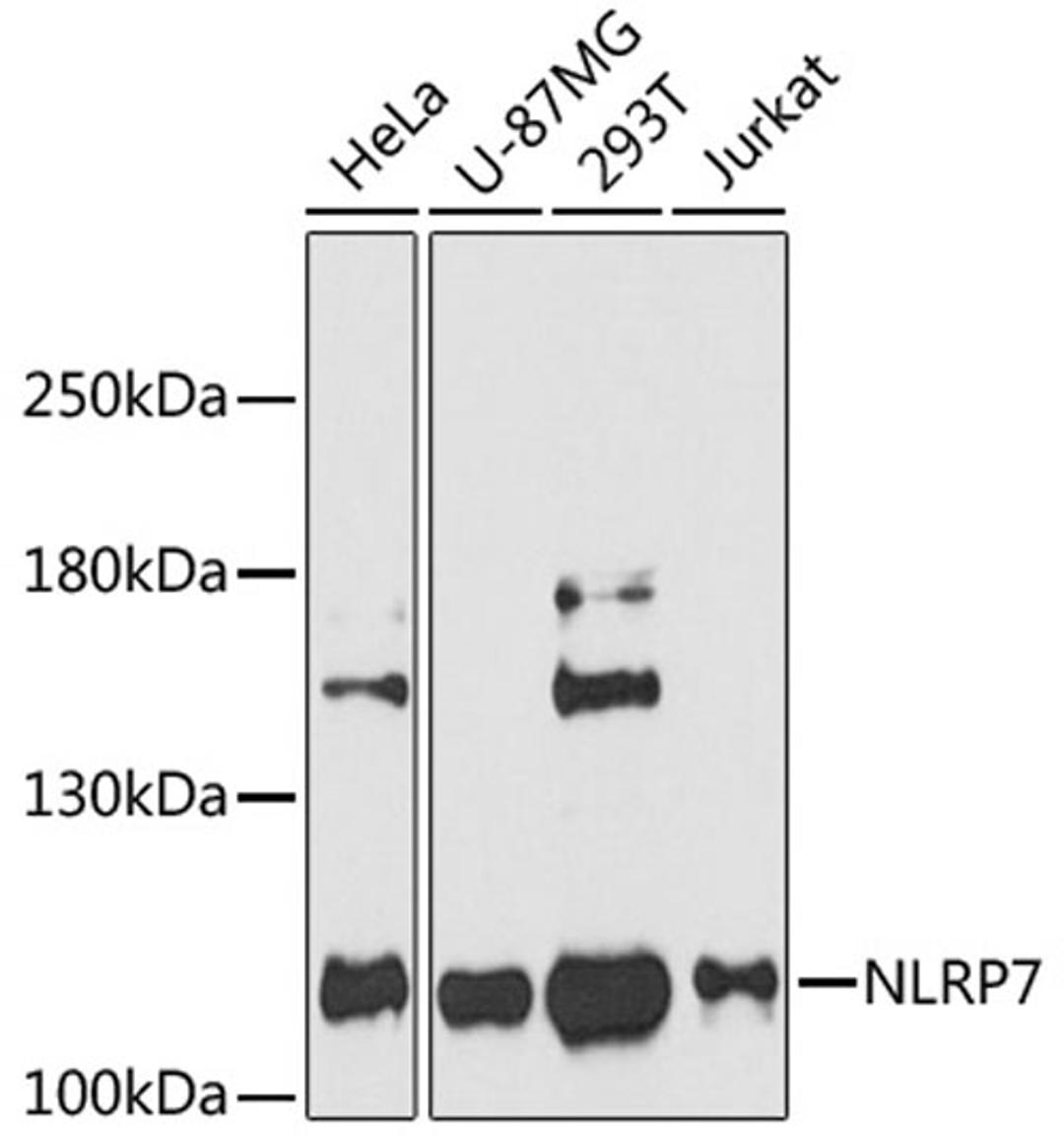 Western blot - NLRP7 Antibody (A11627)