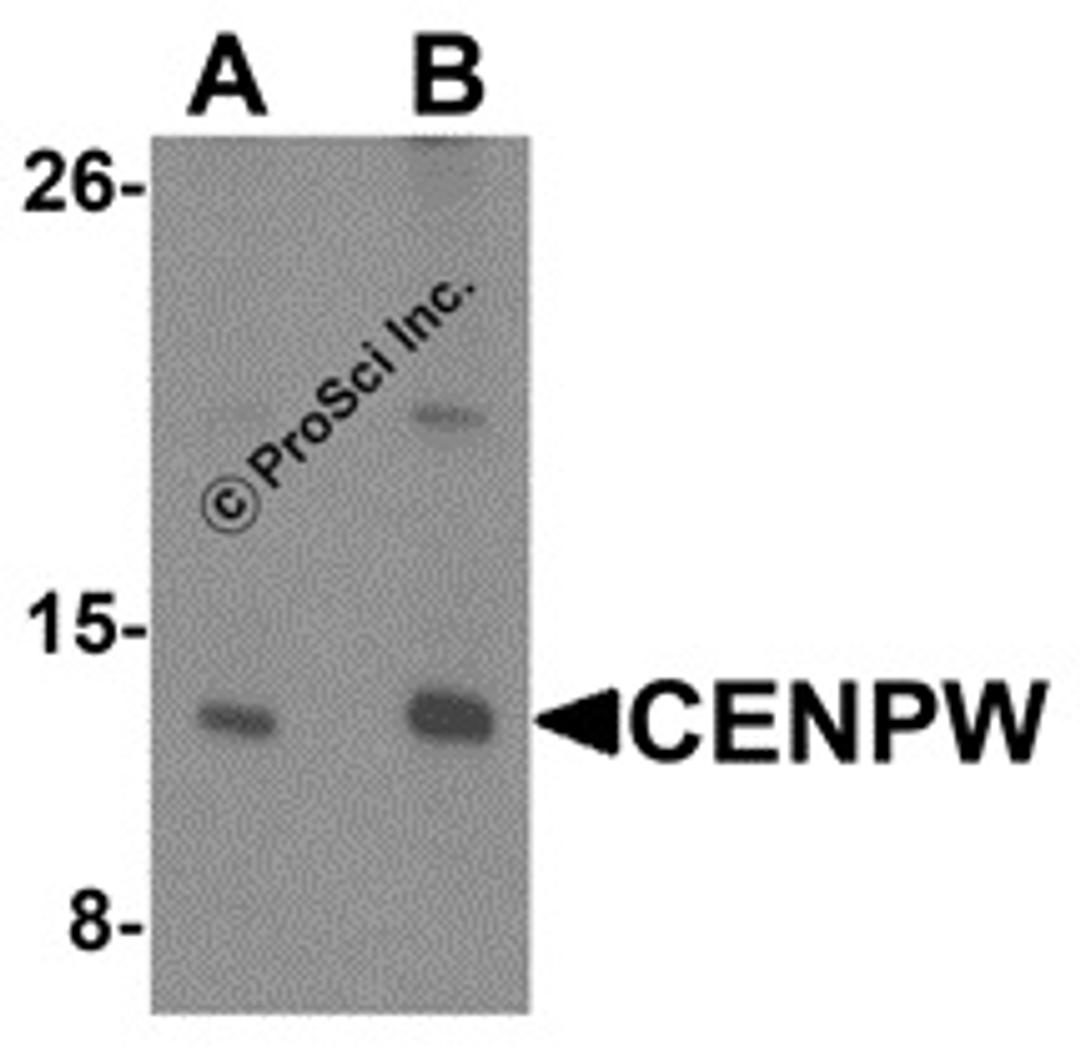 Western blot analysis of CENPW in HeLa cell lysate lysate with CENPW antibody at (A) 0.5 and (B) 1 μg/mL.