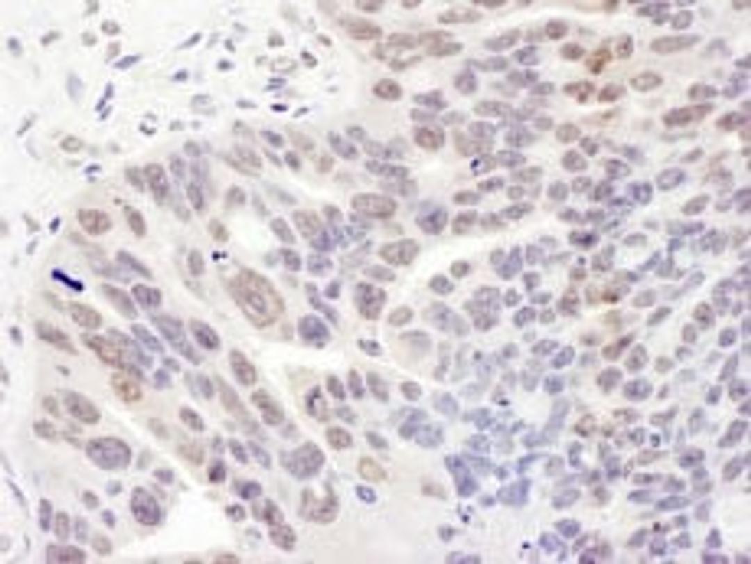 Detection of human REST by immunohistochemistry.