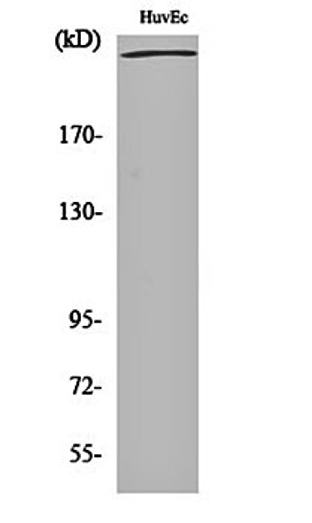 Western blot analysis of HuvEc cell lysates using Filamin 1 antibody