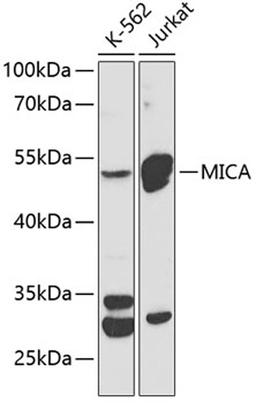 Western blot - MICA Antibody (A12622)