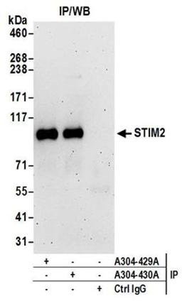 Detection of human STIM2 by western blot of immunoprecipitates.