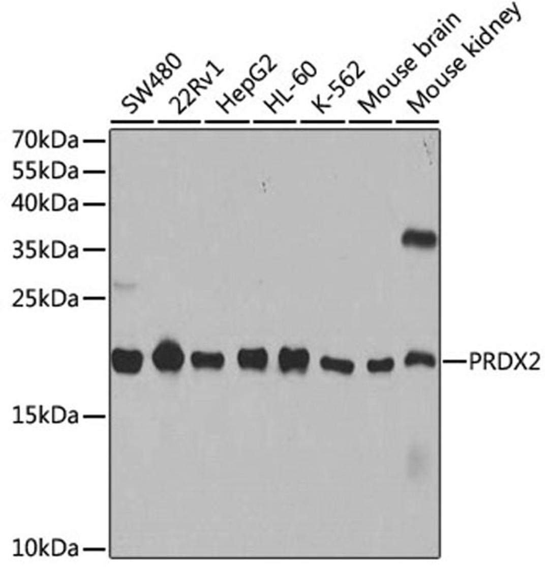 Western blot - PRDX2 antibody (A1919)