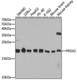 Western blot - PRDX2 antibody (A1919)