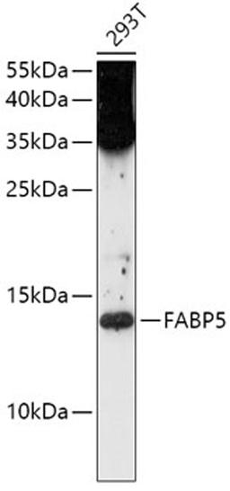 Western blot - FABP5 antibody (A0947)