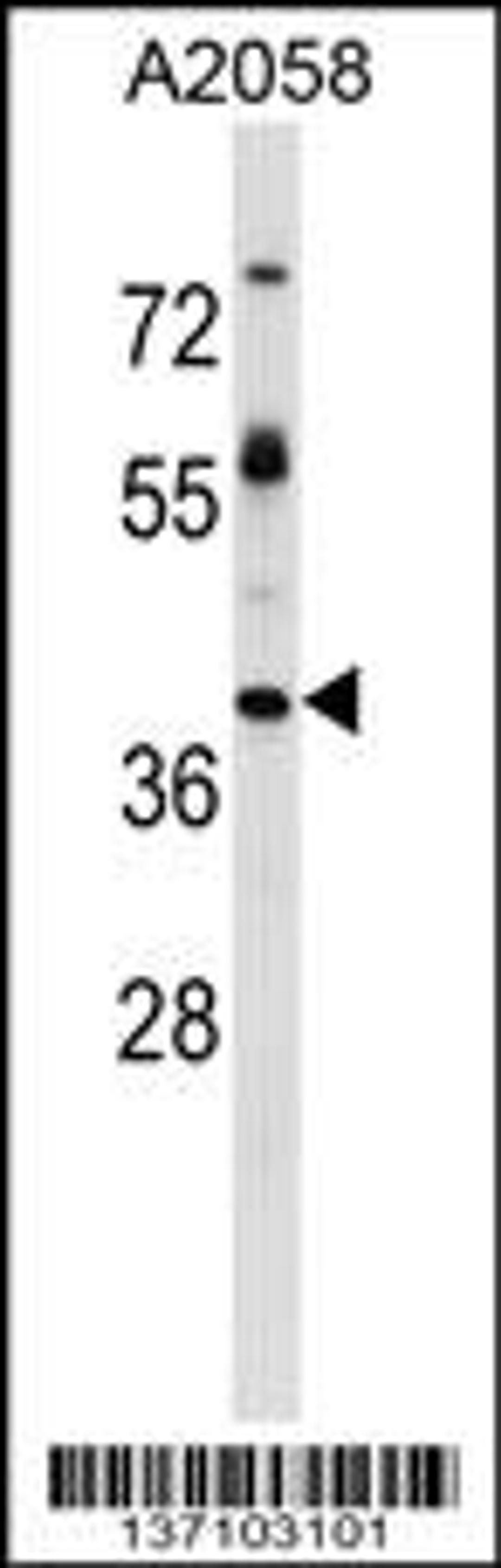 Western blot analysis in A2058 cell line lysates (35ug/lane).