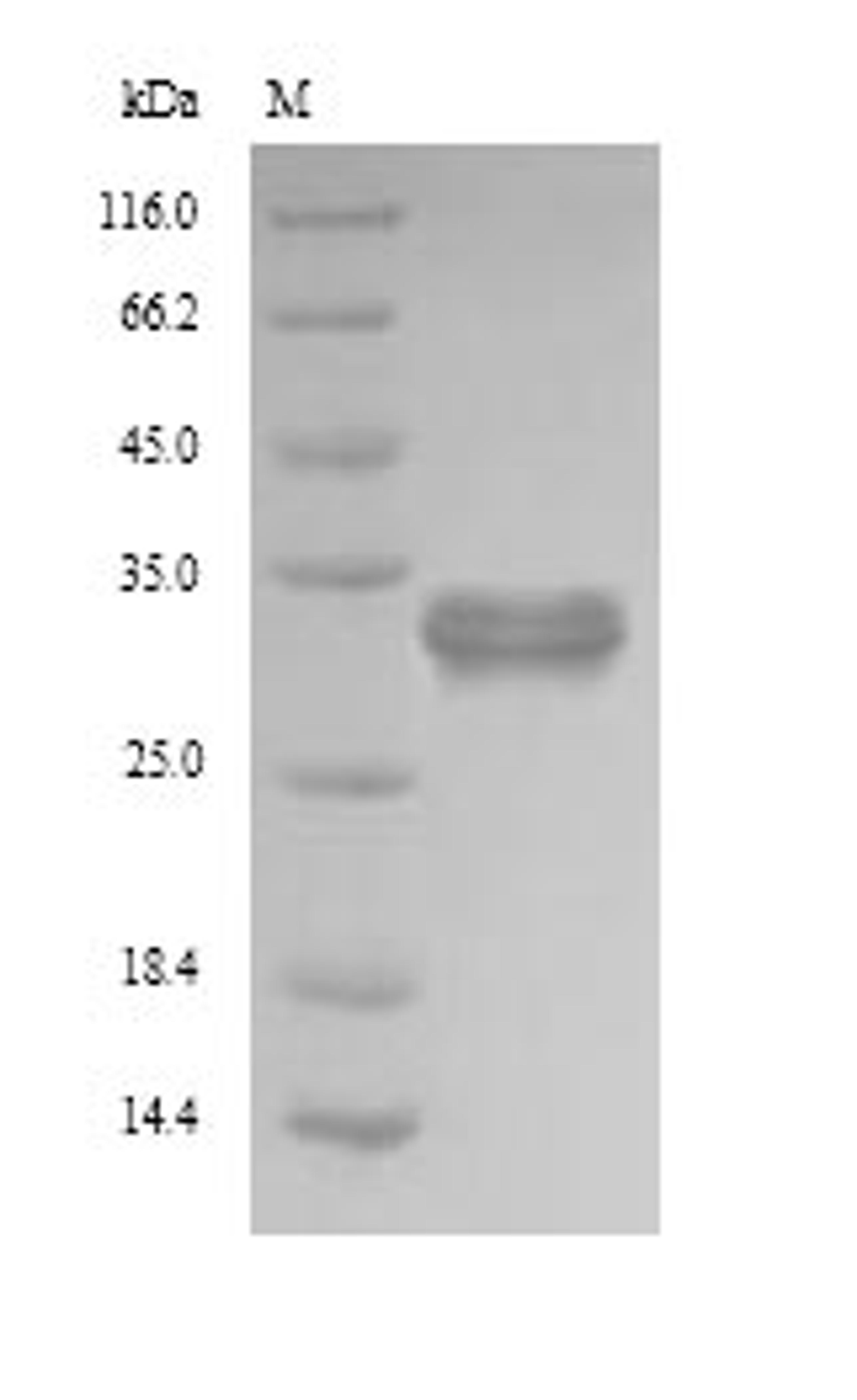 (Tris-Glycine gel) Discontinuous SDS-PAGE (reduced) with 5% enrichment gel and 15% separation gel.