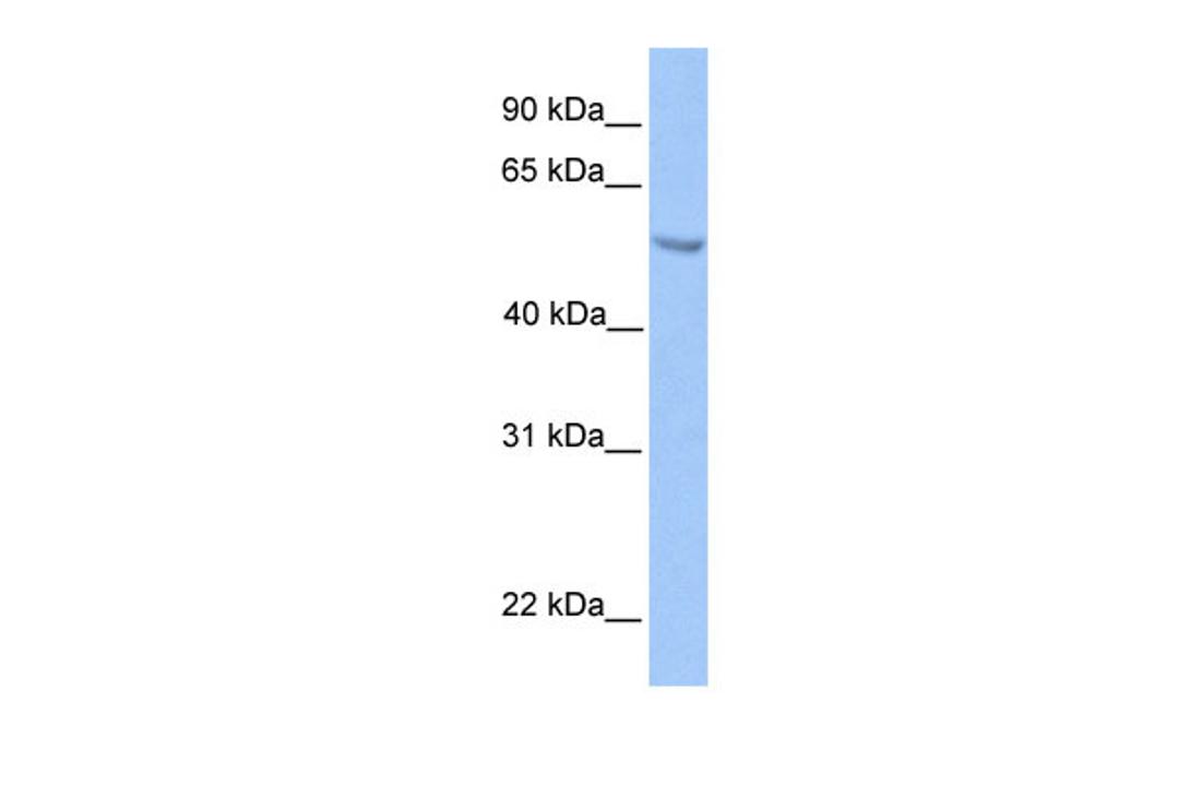 Antibody used in WB on Transfected 293T at 0.2-1 ug/ml.