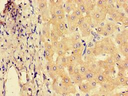Immunohistochemistry of paraffin-embedded human liver tissue using CSB-PA803115LA01HU at dilution of 1:100