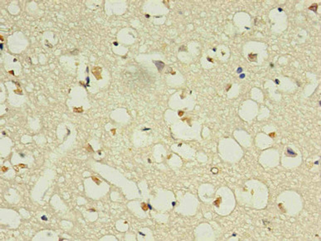 Immunohistochemistry of paraffin-embedded human brain using CSB-MA168601A0m in 30ug/ml dilute concentrations.