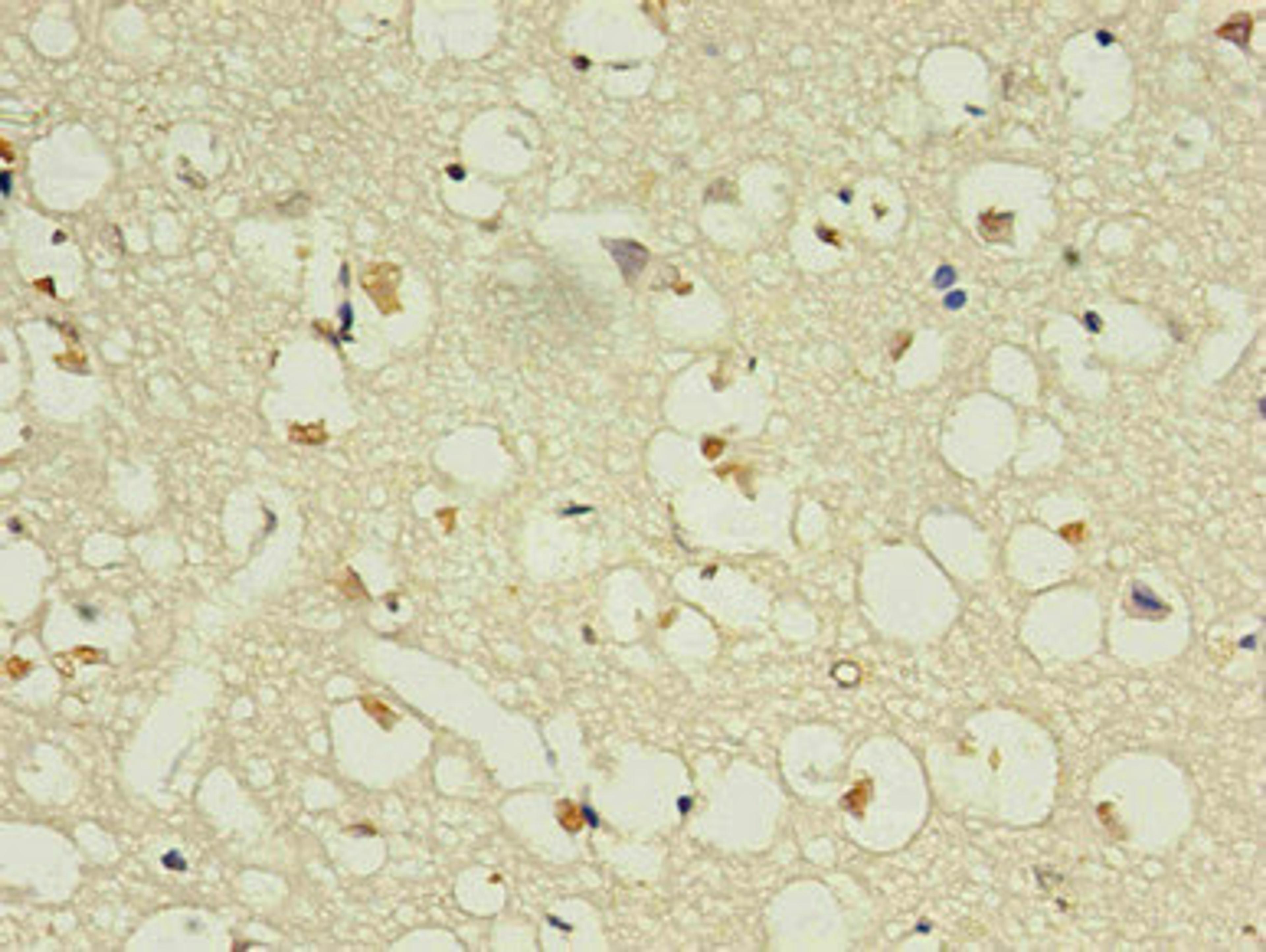 Immunohistochemistry of paraffin-embedded human brain using CSB-MA168601A0m in 30ug/ml dilute concentrations.