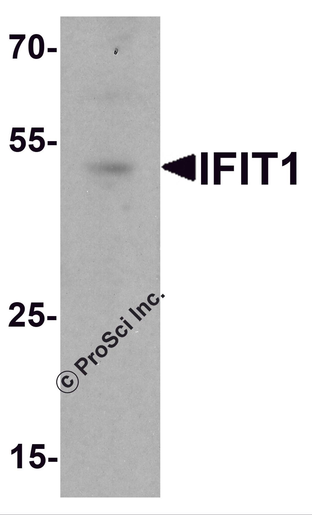 Western blot analysis of IFIT1 in rat small intestine tissue lysate with IFIT1 antibody at 1 μg/ml.