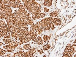 Immunohistochemistry-Paraffin: COX5A Antibody [NBP1-32550] - Paraffin-embedded Cal27 xenograft, using antibody at 1:500 dilution.