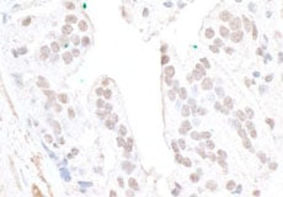 Detection of human FBW7 by immunohistochemistry.