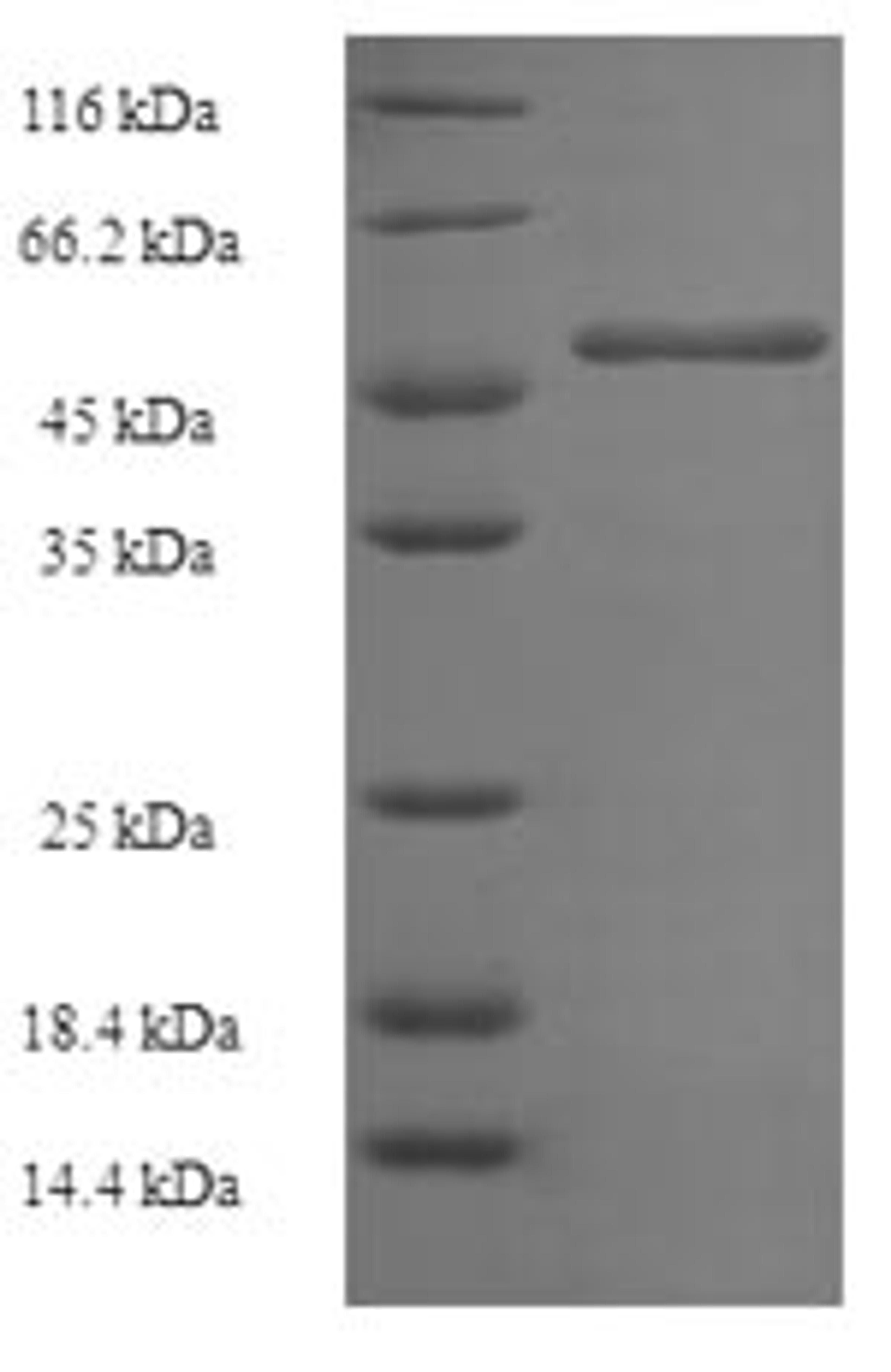 (Tris-Glycine gel) Discontinuous SDS-PAGE (reduced) with 5% enrichment gel and 15% separation gel.