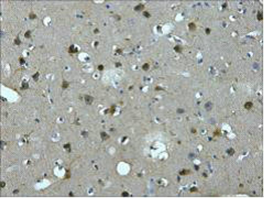 IHC staining of Human brain tissue paraffin-embedded, diluted at 1:200.