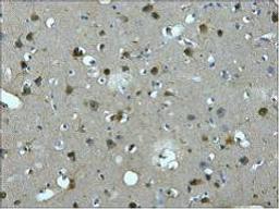 IHC staining of Human brain tissue paraffin-embedded, diluted at 1:200.