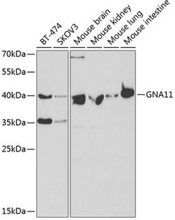 Western blot - GNA11 antibody (A2731)