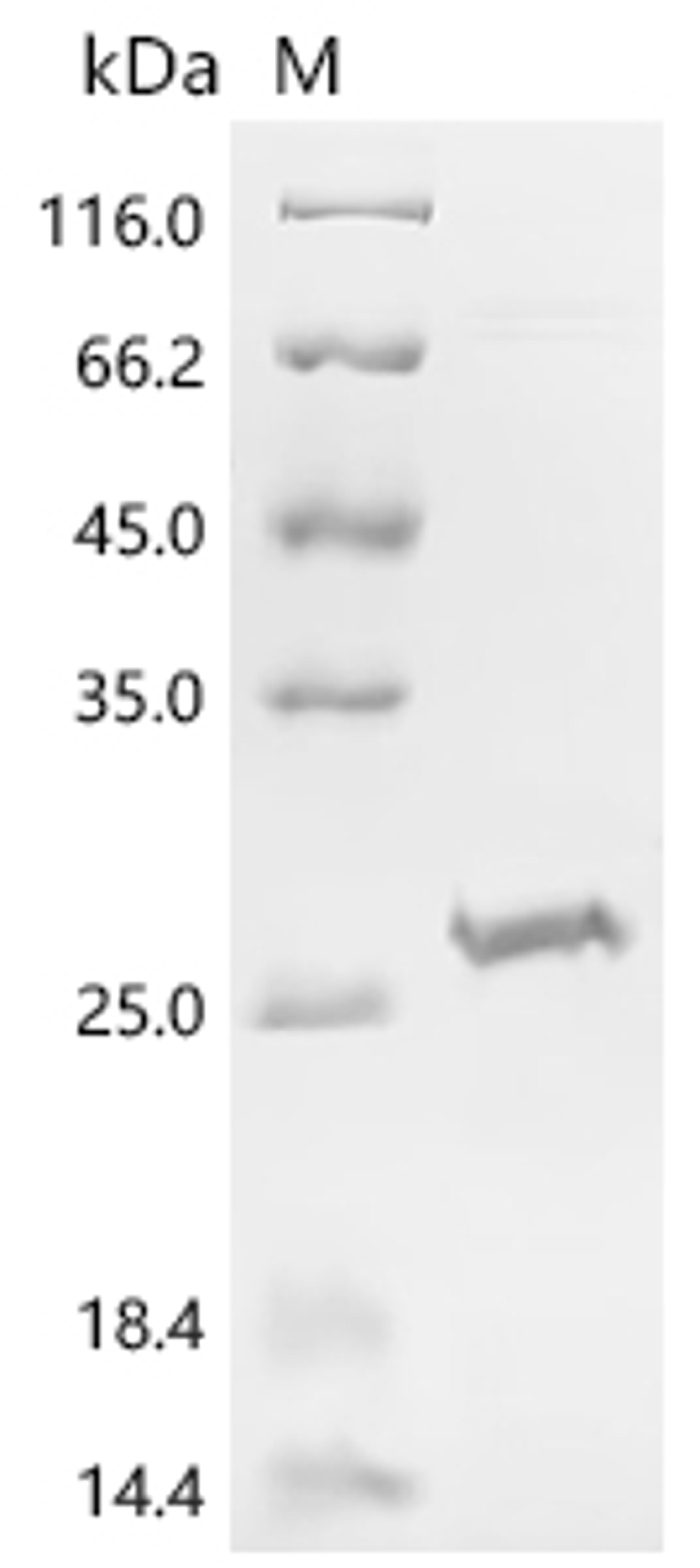 (Tris-Glycine gel) Discontinuous SDS-PAGE (reduced) with 5% enrichment gel and 15% separation gel.
