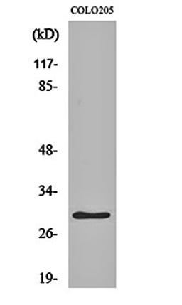 Western blot analysis of COLO205 cell lysates using HLA-DO alpha antibody