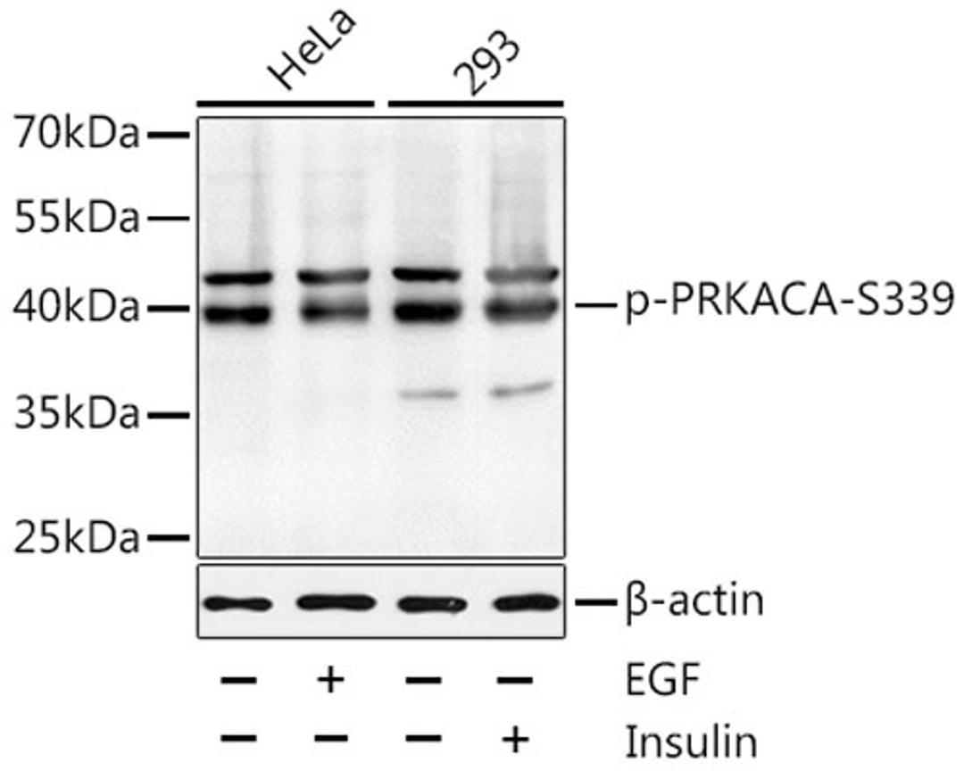 Western blot - Phospho-PRKACA-S339 antibody (AP0558)