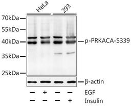 Western blot - Phospho-PRKACA-S339 antibody (AP0558)