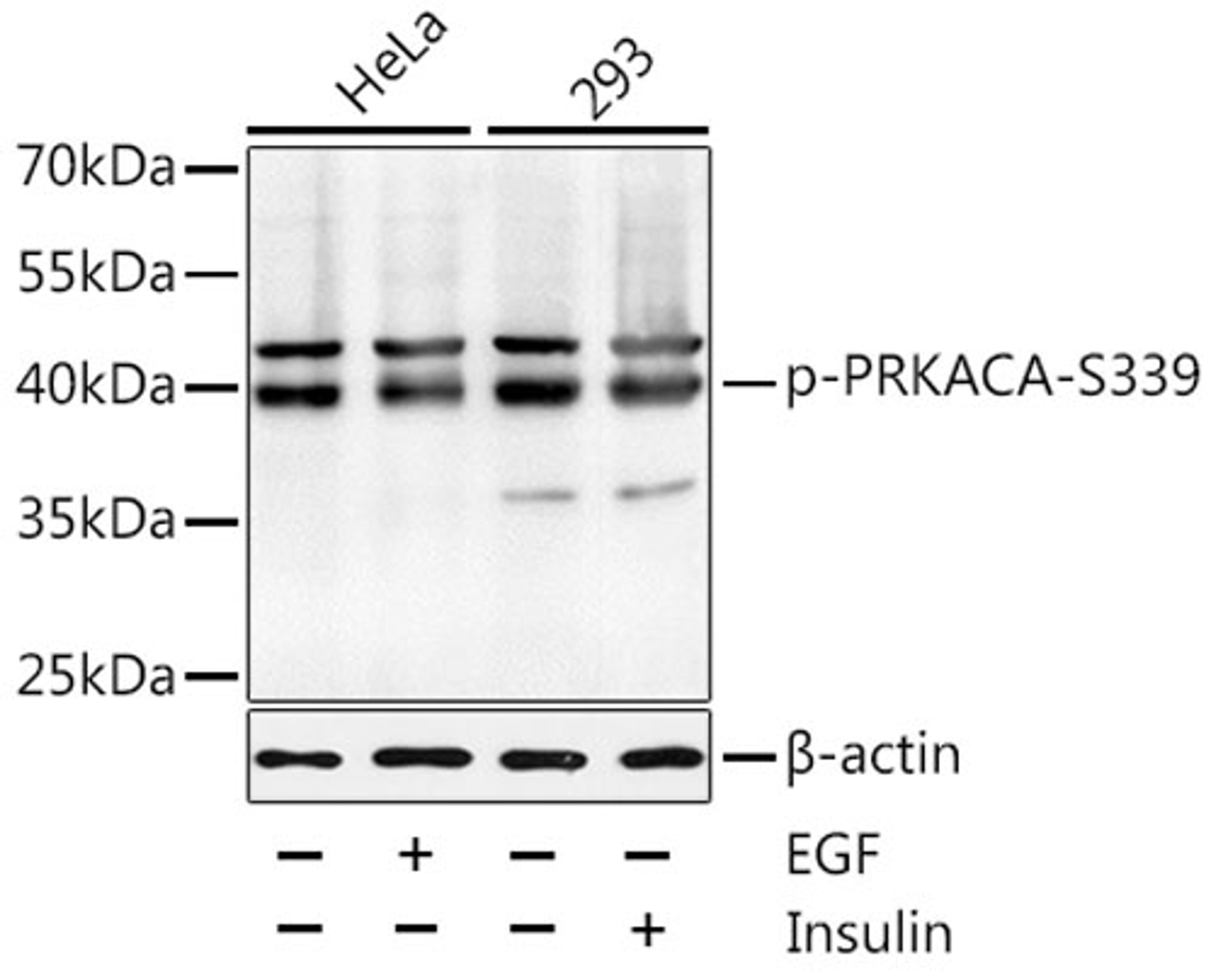 Western blot - Phospho-PRKACA-S339 antibody (AP0558)