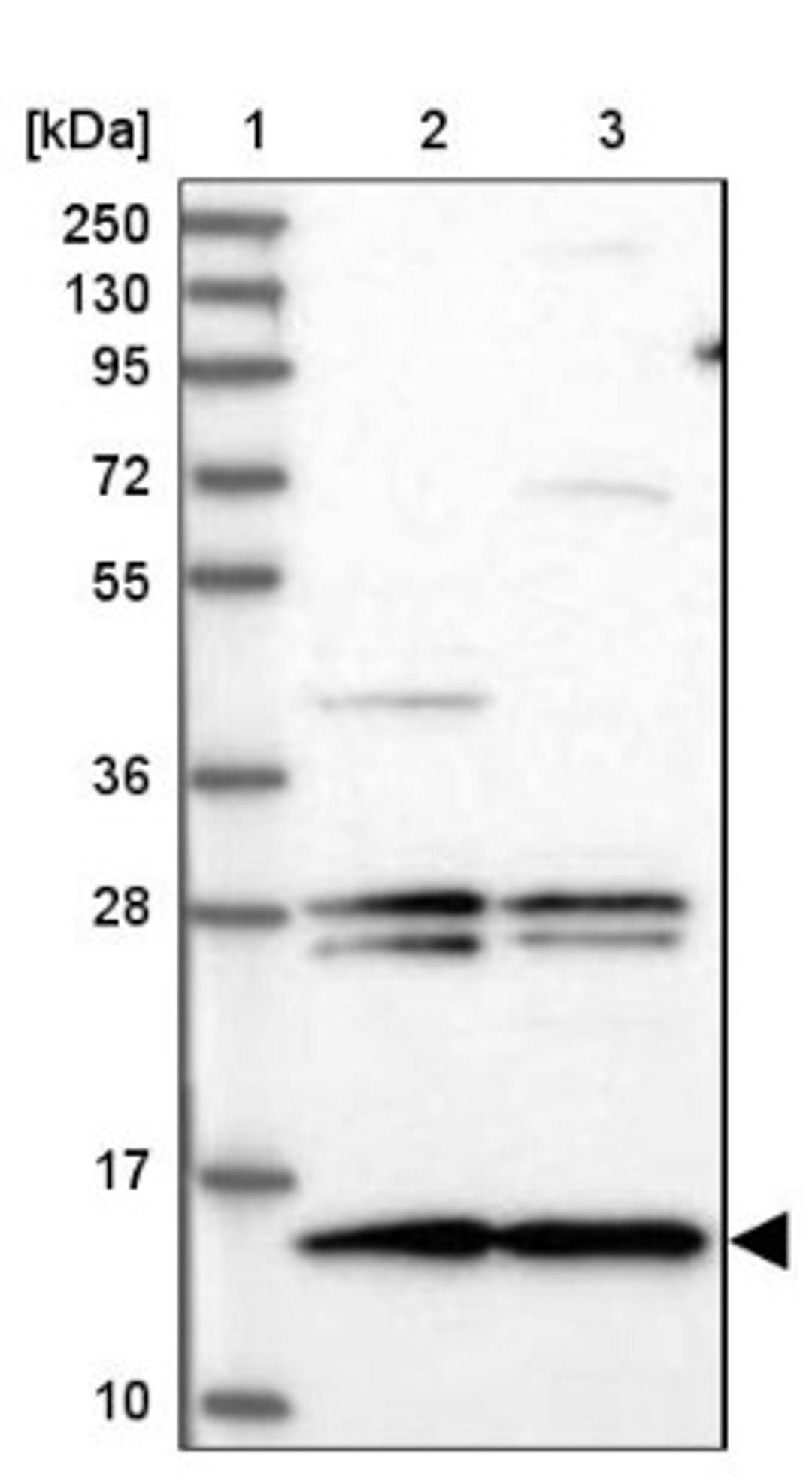 Western Blot: MNF1 Antibody [NBP2-14240] - Lane 1: Marker [kDa] 250, 130, 95, 72, 55, 36, 28, 17, 10<br/>Lane 2: Human cell line RT-4<br/>Lane 3: Human cell line U-251MG sp