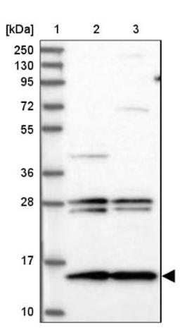 Western Blot: MNF1 Antibody [NBP2-14240] - Lane 1: Marker [kDa] 250, 130, 95, 72, 55, 36, 28, 17, 10<br/>Lane 2: Human cell line RT-4<br/>Lane 3: Human cell line U-251MG sp