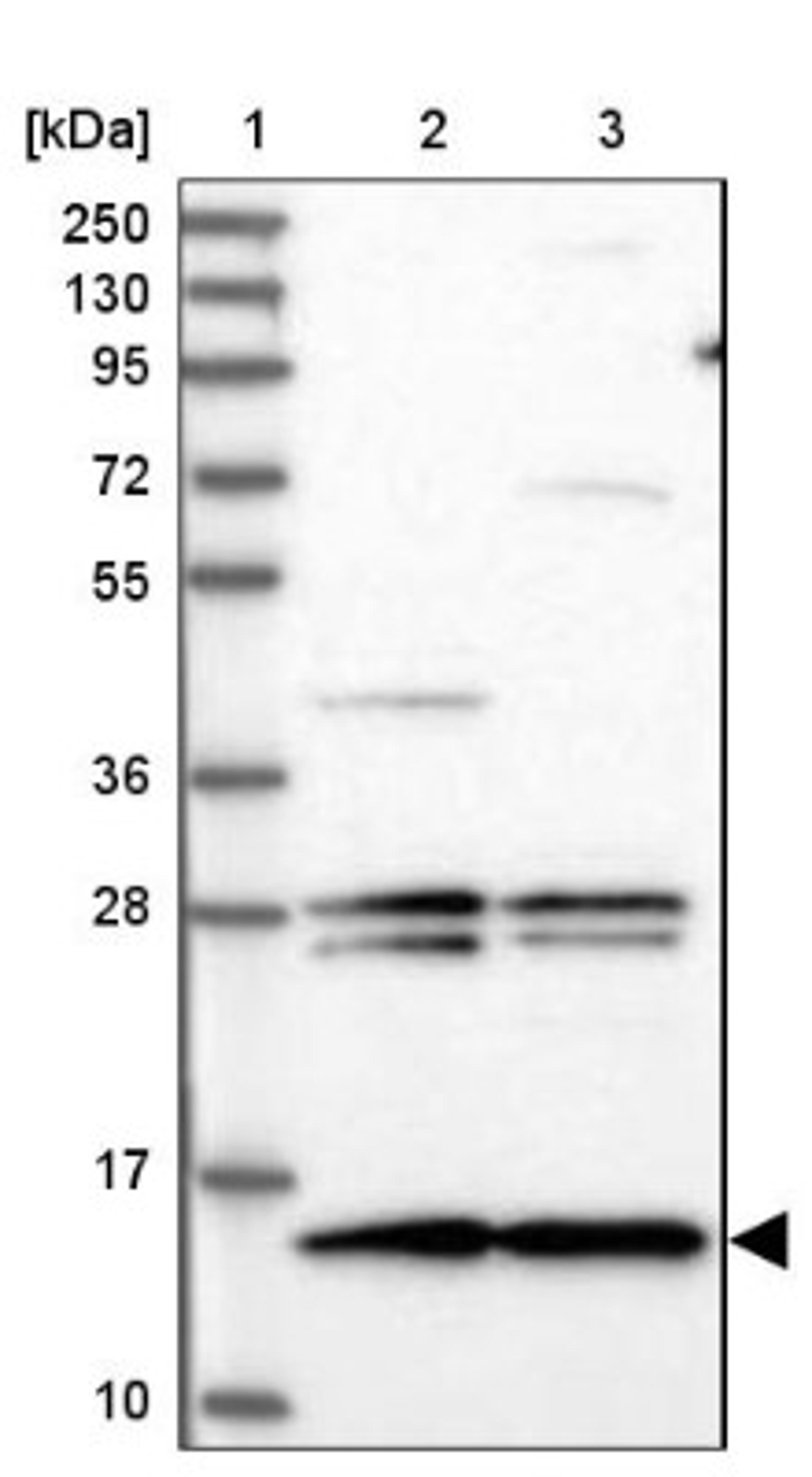 Western Blot: MNF1 Antibody [NBP2-14240] - Lane 1: Marker [kDa] 250, 130, 95, 72, 55, 36, 28, 17, 10<br/>Lane 2: Human cell line RT-4<br/>Lane 3: Human cell line U-251MG sp