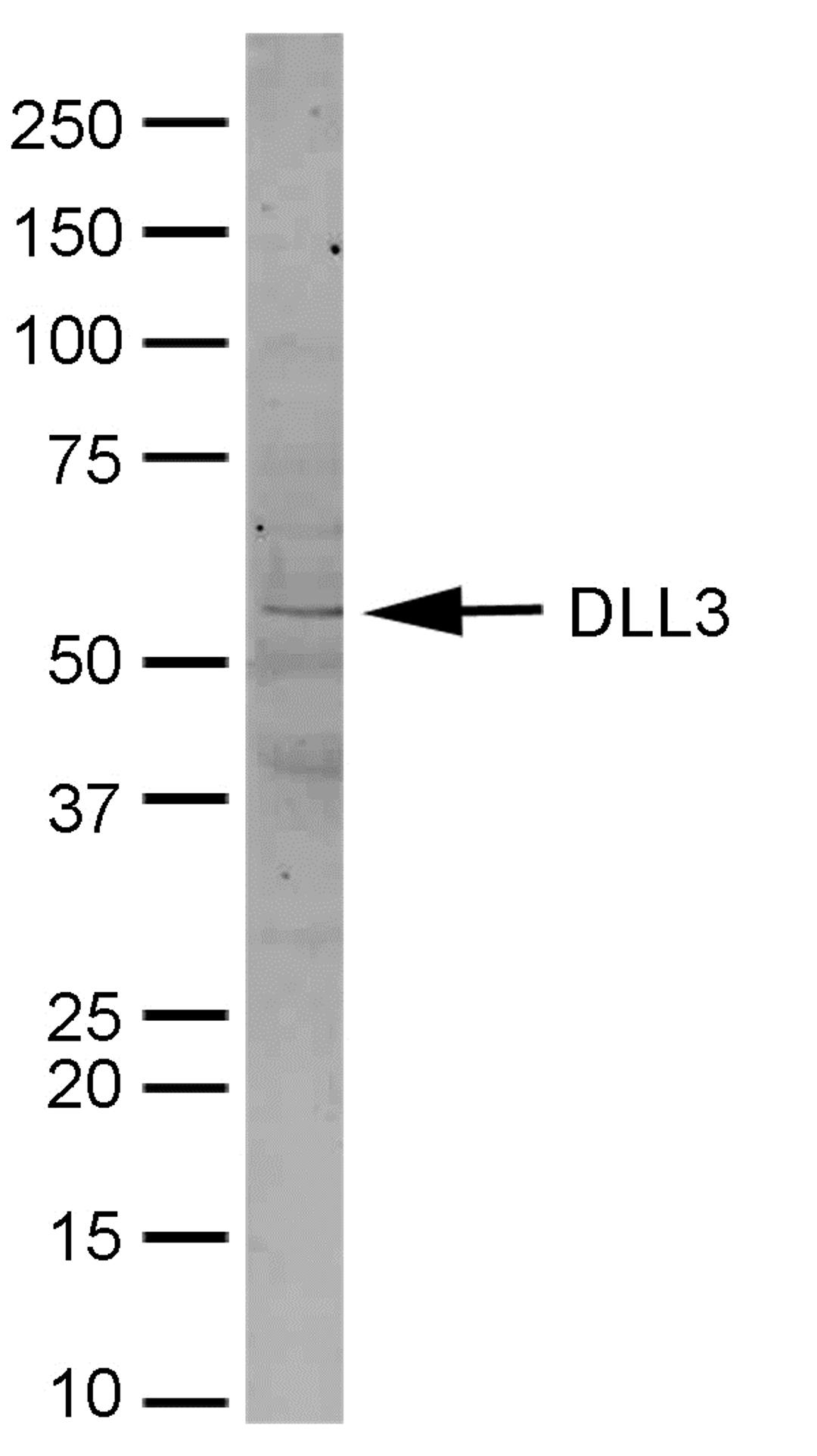 Mouse brain lysate probed with Rabbit anti Mouse Delta-Like Protein 3